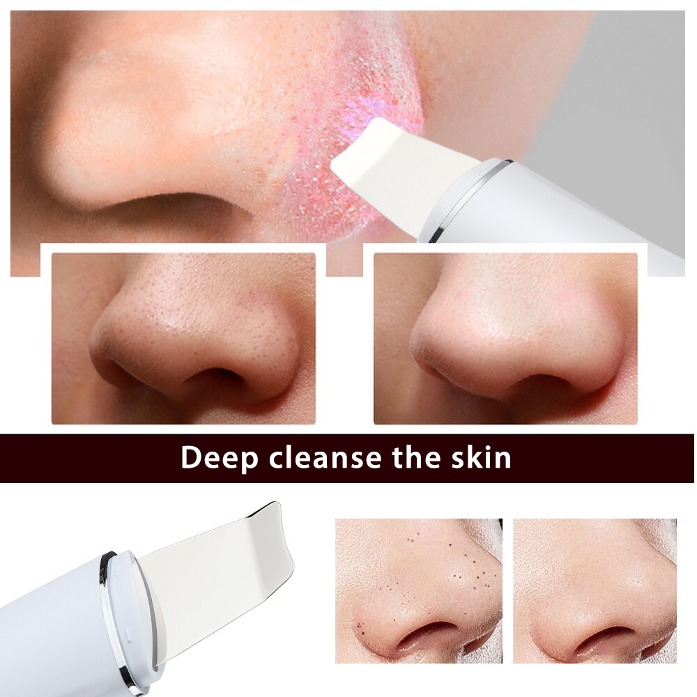 Ultrasonic Skin Scrubber Facial Cleanser